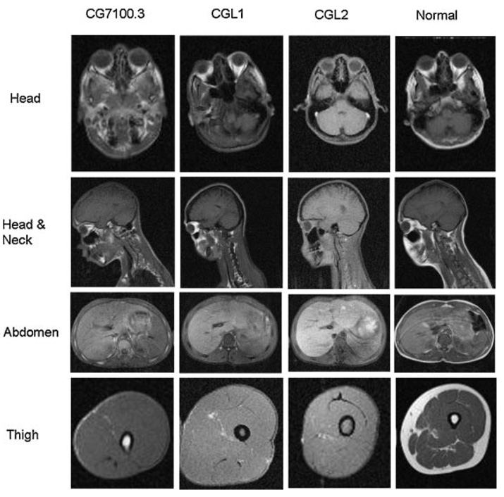 FIG. 6