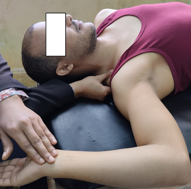 Fig 2