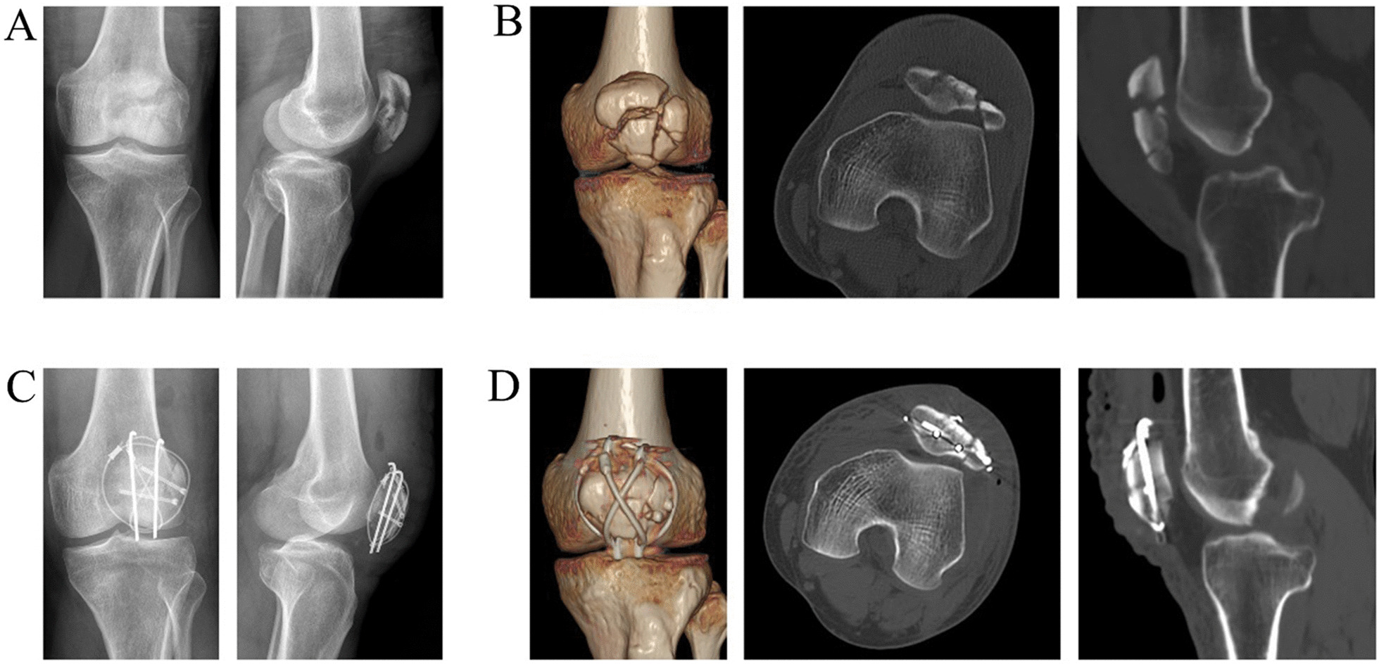 Fig. 3