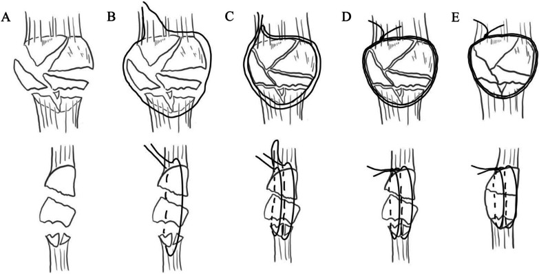 Fig. 1