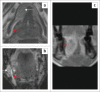 FIGURE 15