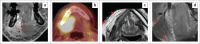 FIGURE 20