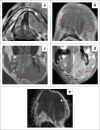 FIGURE 18