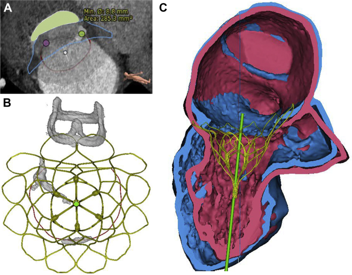 Figure 2