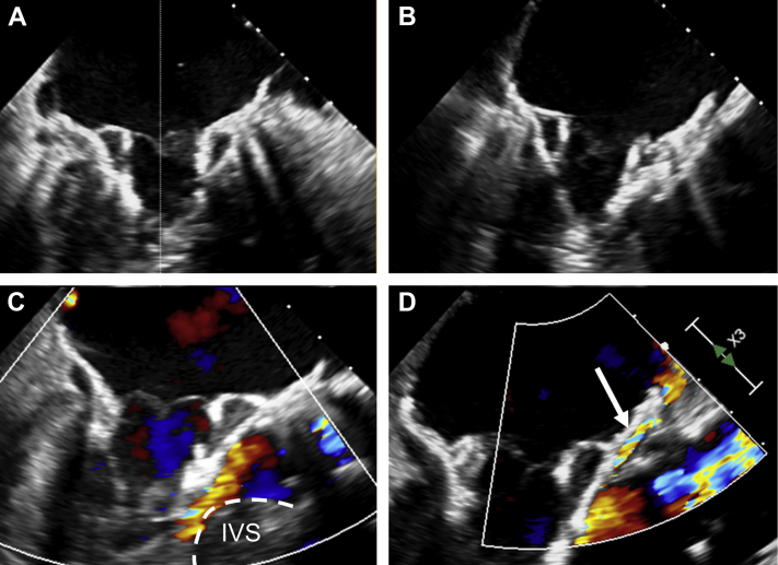 Figure 3