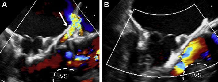 Figure 6