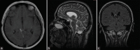 Figure 5: