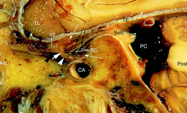 Fig 1.