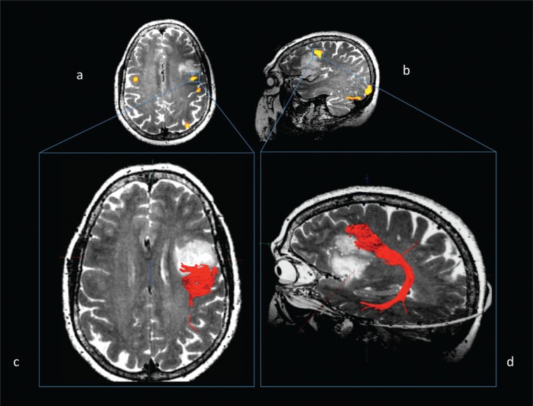 
Figure 1B
