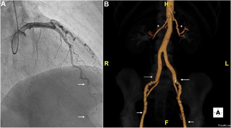 Figure 4