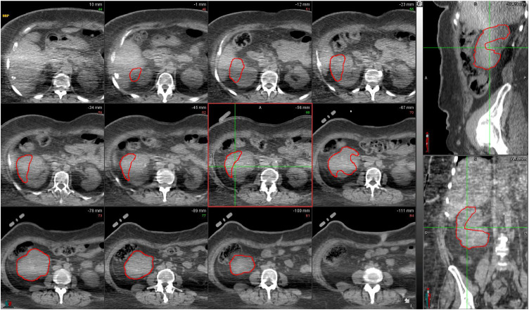 Fig 1