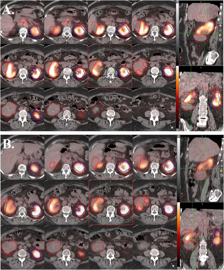 Fig 3