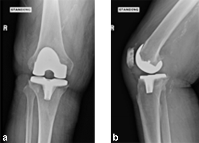 Figure 3