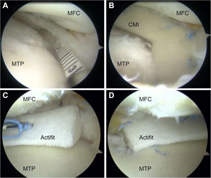 Fig. 4