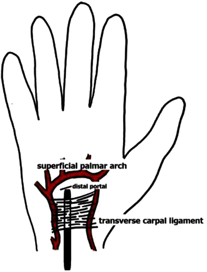 Fig 2