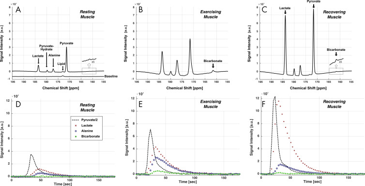 Carbon 13 (13C) spectra and time courses of 13C metabolites acquired at rest and with exercise using hyperpolarized (HP) [1-13C]-pyruvate. a.u. = arbitrary units. A–C,13C spectra were averaged during the first 90 seconds after a bolus injection of HP [1-13C]-pyruvate in 62-year-old man (participant 3), A, at rest, B, during plantar flexion exercise, and, C, during postexercise recovery. Peak at 172.7 ppm is from natural abundance of 13C lipids. D–F, Time courses of HP 13C metabolites. Time-resolved [1-13C]-pyruvate (dashed line), [1-13C]-lactate (×), [1-13C]-alanine (open circle), and [13C]-bicarbonate (gray circle) from participant, D, at rest, E, during exercise, and, F, during postexercise recovery.