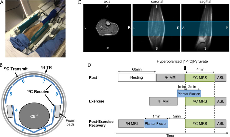 Experimental set-up and study protocol. A, Photograph depicts positioning of calf muscle in carbon 13 (13C)–hydrogen 1 (1H) dual-frequency radiofrequency coil before connecting anterior part of coil. B, Illustration shows how calf muscle was wrapped with flexible posterior 13C array receiver coils (channels 1–4). TR = transmit and receive. C, Localized single-shot fast spin-echo 1H MRI scans obtained using radiofrequency coil. Blue region indicates prescribed axial slab for 13C MR spectroscopy (10-cm thick). A = anterior, I = inferior, L = left, P = posterior, R = right, S = superior. D, Diagram shows how dynamic 13C MR spectroscopy (MRS) was performed at three metabolic states—rest, exercise, and recovery. ASL = arterial spin labeling.