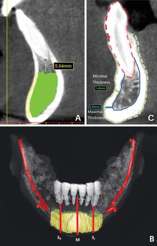 Fig. 3