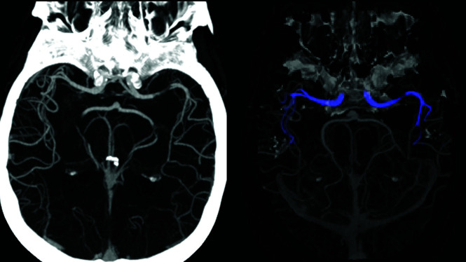 FIG 5.