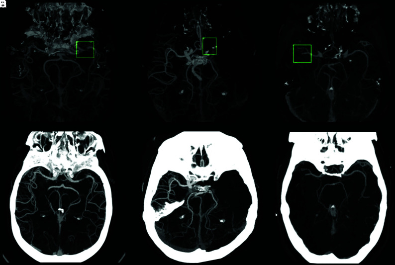 FIG 6.