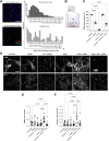 Figure 1. Inhibition of mast cell degranulation suppresses myofibroblast differentiation and activity. A, Representative fluorescence images of human tissue arrays showing the proximity of tryptase-positive mast cells (green color) to αSMA-positive CAFs (red color) in tumor tissue (top) as compared with normal tissue (bottom); scale bar = 0.2 mm (n = 4–6 human tissue arrays). B, Transwell coculture system used for the in vitro evaluation of MC/9 mast cells and NIH3T3 fibroblasts interaction. C, Inhibition of MC/9 degranulation after exposure to ketotifen. For the analysis of MC degranulation, we measured the release of β-hexosaminidase into the culture medium (n = 3 independent experiments, N = 6 technical replicates per experiment). D, Images of immunofluorescence staining of αSMA and collagen I in fibroblasts; scale bar = 0.1 mm. E, Quantification of αSMA and (F) collagen I–positive staining normalized to DAPI nuclear staining. Data, mean ± SE. For C, E, and F, statistical analyses were performed by comparing means between two independent groups using the ordinary one-way ANOVA test. (B, Created with BioRender.com.)