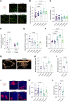 Figure 4. Ketotifen restores tumor vessel functionality and perfusion. A, Representative immunofluorescence images of NG2 pericyte marker (green) and CD31 endothelial cell marker (red) of MCA205 tumors upon treatment with different ketotifen concentrations; scale bar = 0.1 mm. B, Quantification of vessel pericyte coverage as indicated by CD31 and NG2 overlapping staining (yellow) normalized to total CD31+ staining. C, Quantification of area fraction positive for CD31 staining (vessels; n = 5 mice per group, N = 3–5 image fields per mouse). D, Quantification of mRNA expression levels of IFNγ and VEGF in untreated and ketotifen (10 mg/kg) treated MCA205 tumors using the 2−ΔΔCT method (3 biological × 3 technical replicates were used). E, Interstitial fluid pressure levels in untreated and daily ketotifen-treated mice for 7 days (n = 7 mice per treatment group). F, Quantification of open lumen fraction in MCA205 tumors based on CD31 image analysis. G, Representative contrast-enhanced ultrasound images of microbubbles (yellow) entering MCA205 tumors for control and 10 mg/kg ketotifen-treated tumors at the time of peak intensity. The dashed line shows the tumor margin. H, Normalized perfused area with respect to the total tumor area at the time of peak intensity for MCA205 and (I) K7M2 tumors, after completion of treatment protocol (Fig. 2A; n = 4–5). J, Representative immunofluorescence images of MCA205 paraffin sections stained for pimonidazole adducts following pimonidazole hydrochloride injection; scale bar = 0.2 mm. Quantification of hypoxia area fraction (red) normalized to DAPI stain (blue) of (K) MCA205 and (L) K7M2 tumors (n = 5 mice per group, N = 3–5 image fields per mouse). Data are presented as mean ± SE. Statistical analyses were performed by comparing means between two independent groups using the two independent groups using the ordinary one-way ANOVA test for B, D–F, H, K–L and the unpaired parametric Welch t test for C and I.
