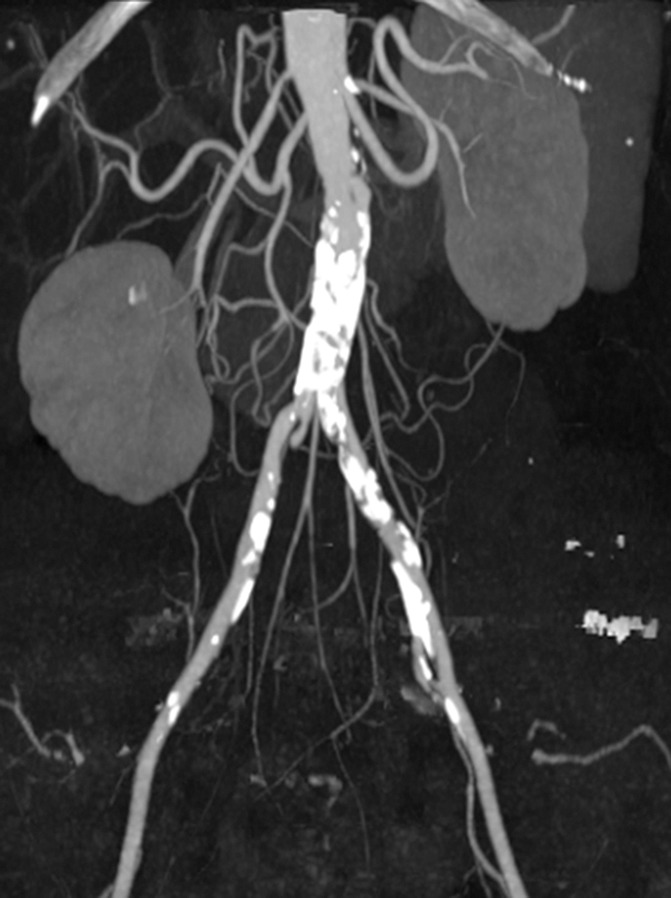 Dual- and Multi-Energy CT: Principles, Technical Approaches, and ...