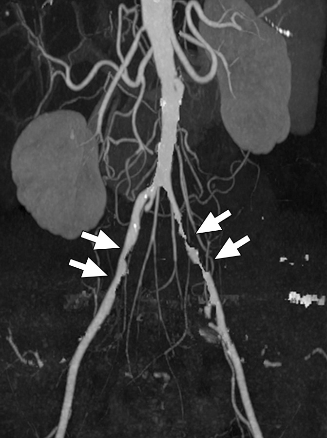 Dual- and Multi-Energy CT: Principles, Technical Approaches, and ...