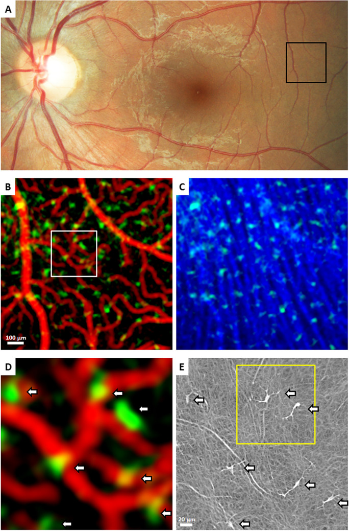 Fig. 2