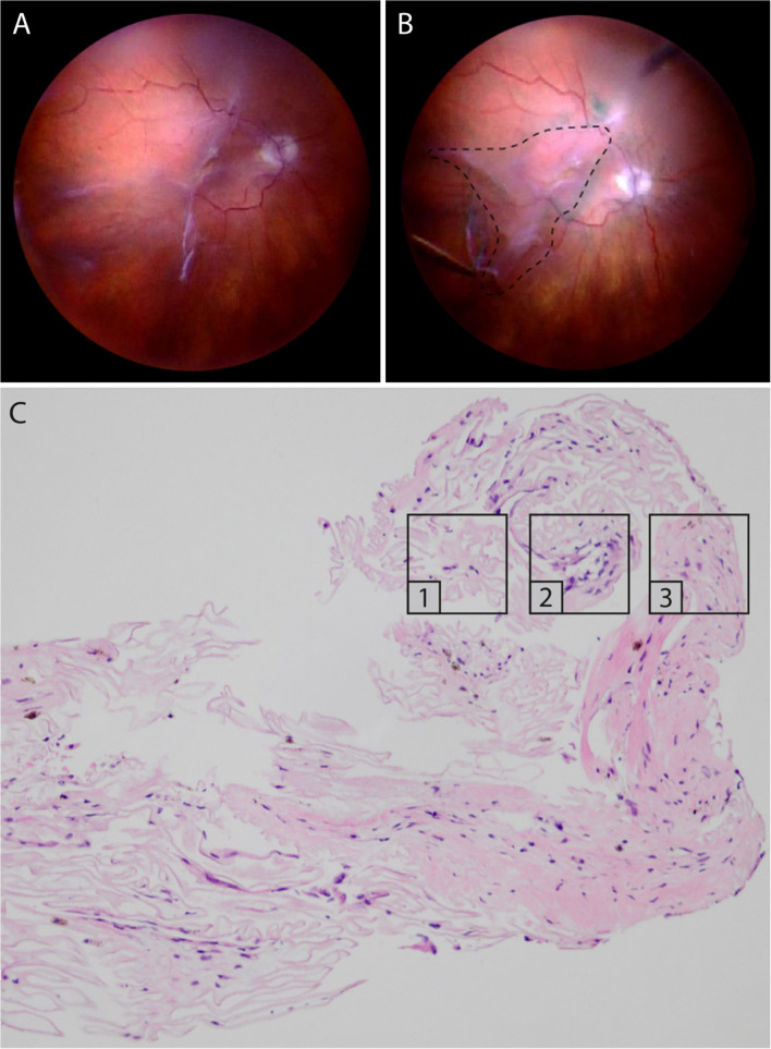 Fig. 6