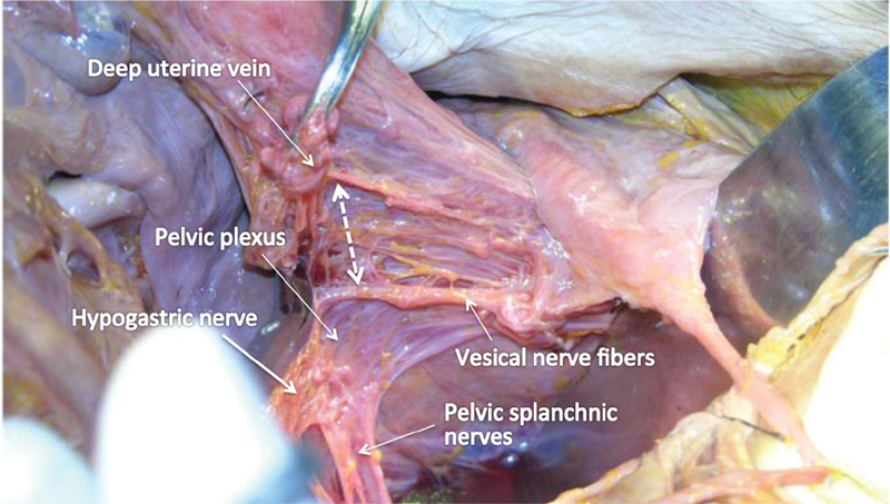 Fig. 25