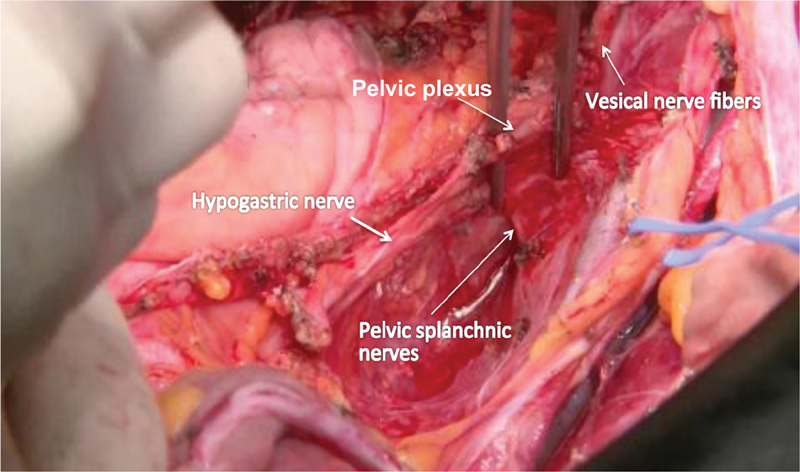 Fig. 23
