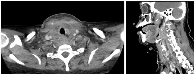 Figure 1 and 2.