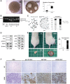 Figure 4. HPC-derived organoids generated from LiKM mice showed tumor-formation ability in an allograft model. Organoids were generated from 0.50 g liver samples in LiK and LiKM mice. A, Representative pictures and numbers of organoids larger than 200 μmol/L 10 days after isolation from the livers (N = 7 per group). B, PCR of the DNA isolated from the organoids, whole livers, and tails of the indicated genotypes and specimens. C, Karyotyping of organoid-consisting cells (N = 100 per group). Two lines of organoids were generated in each genotype. Fifty cells were examined for karyotyping in each line. D, Protein expression in organoids. Organoids were inoculated into NOG mice for allografts (E and F). E, Macroscopic appearance of mice 21 days after organoid inoculation and the tumorigenesis rate. Arrowheads indicate the allograft. F, H&E staining and IHC for pan CK, AFP, and CD133 in allografts (×400). *, P < 0.05.