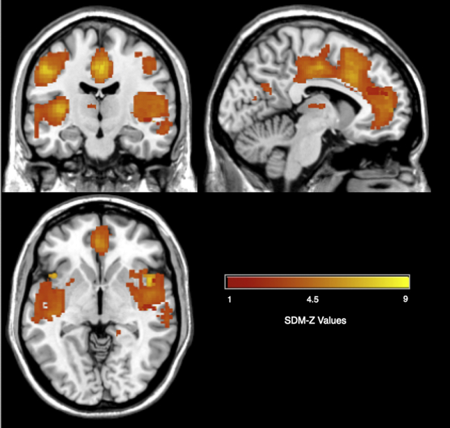 Figure 1