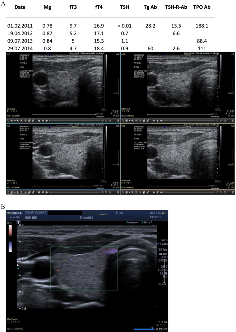 Fig. 1