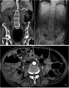 Fig. 1