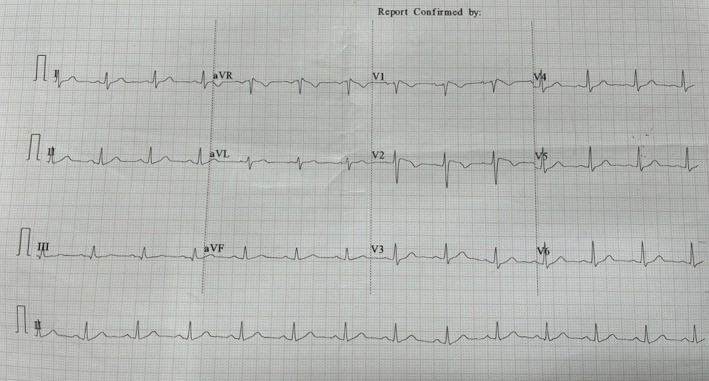 FIGURE 1