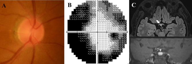 Fig. 4