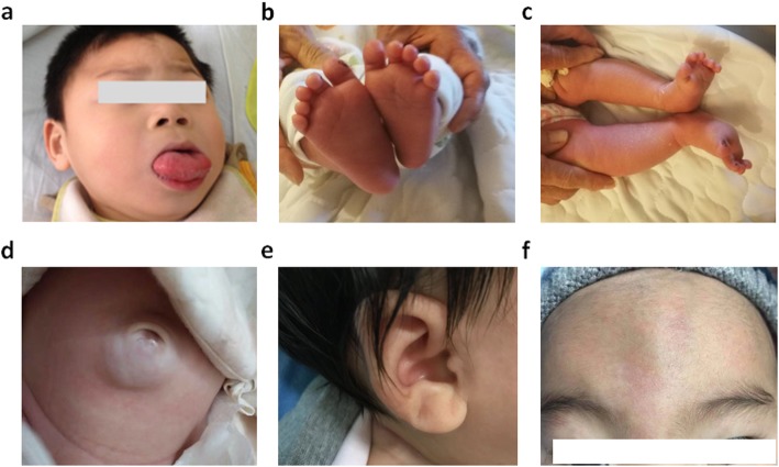 Fig. 1