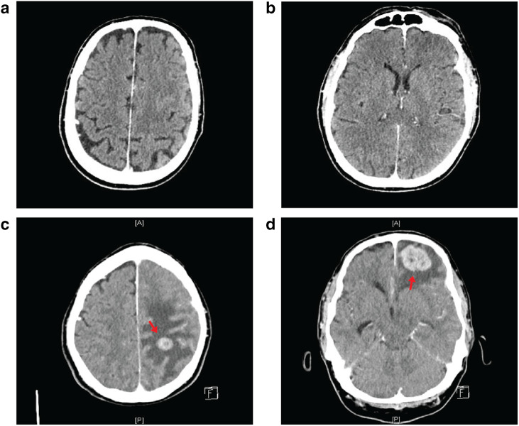 Fig. 3