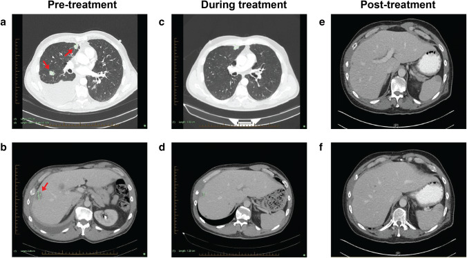 Fig. 2