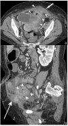 Figure 16