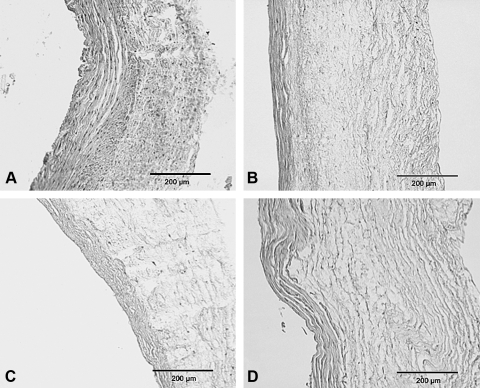 FIG. 12.