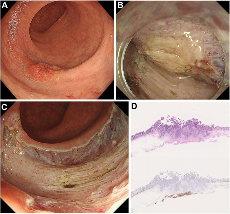 graphic file with name gr1.jpg