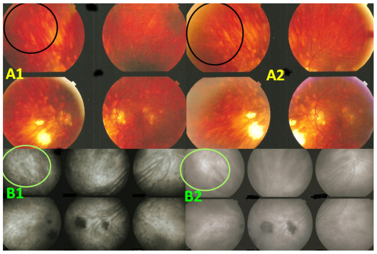 Figure 12