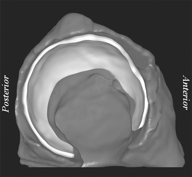 Figure 3b: