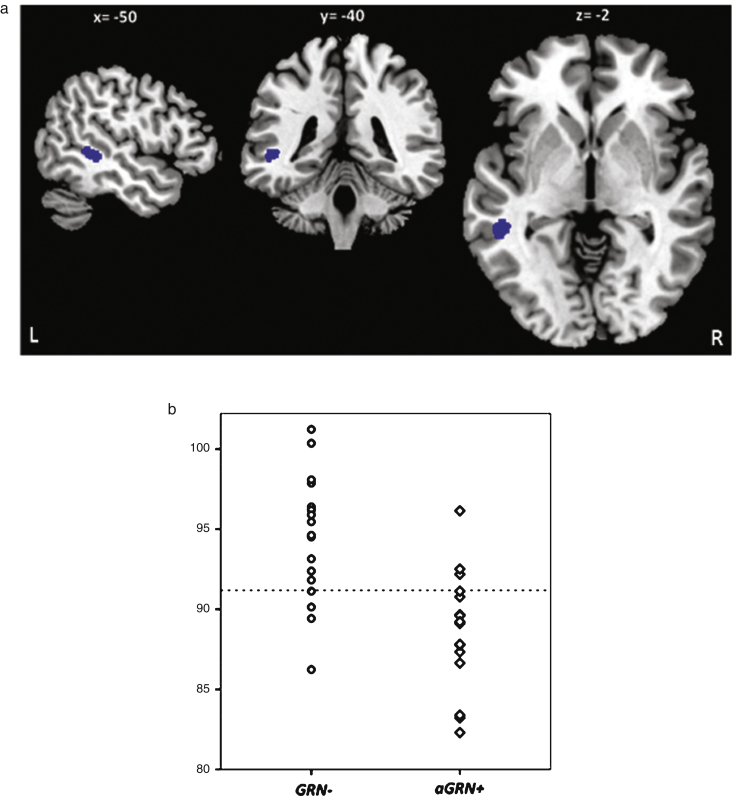 Fig.2