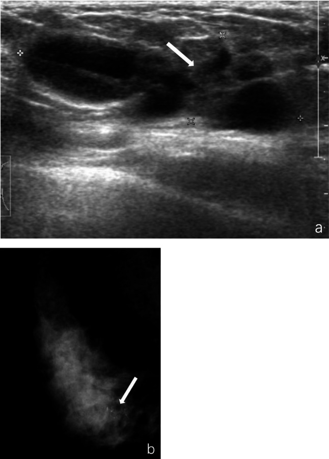 Fig. 4