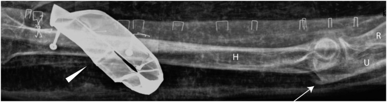 Fig 6